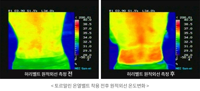 토르말린 온열밸트 착용 전후 원적외선 온도변화