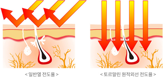 왼쪽사진 : 일반열 전도율, 오른쪽사진 : 토르말린 원적외선 전도율